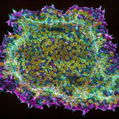 Embryonic stem cell colony, immunostained — densely packed cells with bright nuclei surrounded by a fluorescent margin of supporting structures.