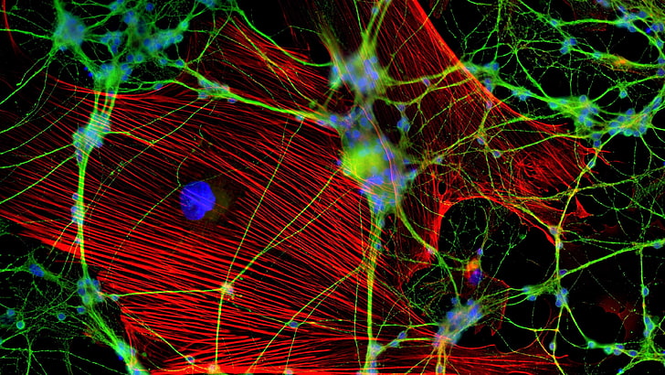 Immunostained neurons rendered in monochrome — dense radiating fibres against a dark field.